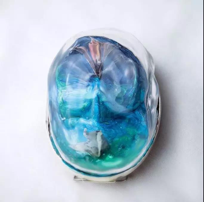 童年的相片和童話書被包裹進泡泡般回憶